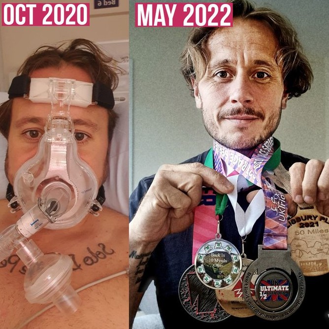 Running Tales podcast: Martin Lopez – From Covid induced intensive care to ultra marathoner